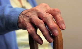 Arthritis and arthrosis of fingers in an elderly person