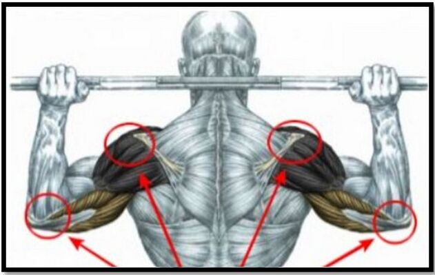 Load on the muscles of the shoulder and elbow is one of the causes of arthrosis of the shoulder joint